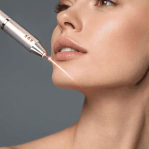 LaseMD® 1927 Laser Skin Tightening Session