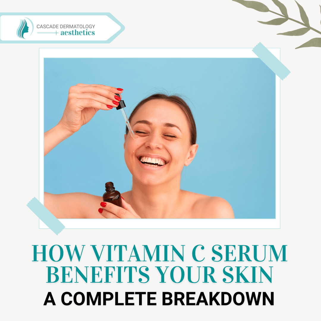 How Vitamin C Serum Benefits Your Skin: A Complete Breakdown